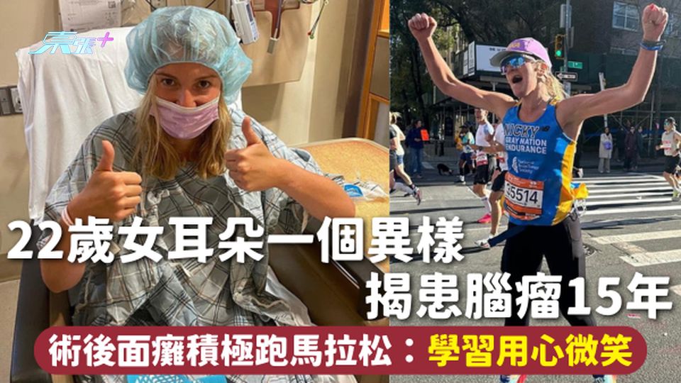 腦瘤 | 22歲女耳朵一個異樣揭患腦瘤15年 術後面癱積極跑馬拉松：學習用心微笑
