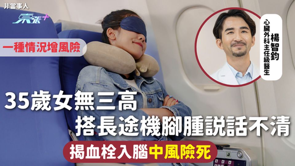 中風 | 35歲女無三高 搭長途機腳腫說話不清 揭血栓入腦中風險死 一種情況增風險
