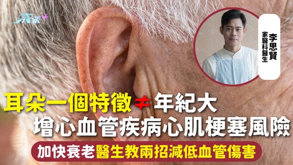 身體警號 | 耳朵一個特徵≠年紀大 增心血管疾病心肌梗塞風險 加快衰老醫生教兩招減低血管傷害