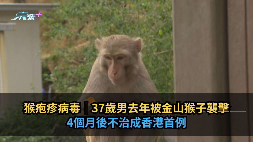 猴疱疹病毒|37歲男去年被金山猴子襲擊 4個月後不治成香港首例