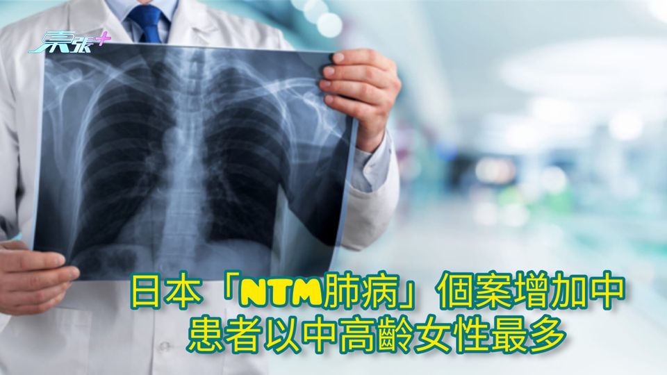 日本「NTM肺病」個案增加中 患者以中高齡女性最多
