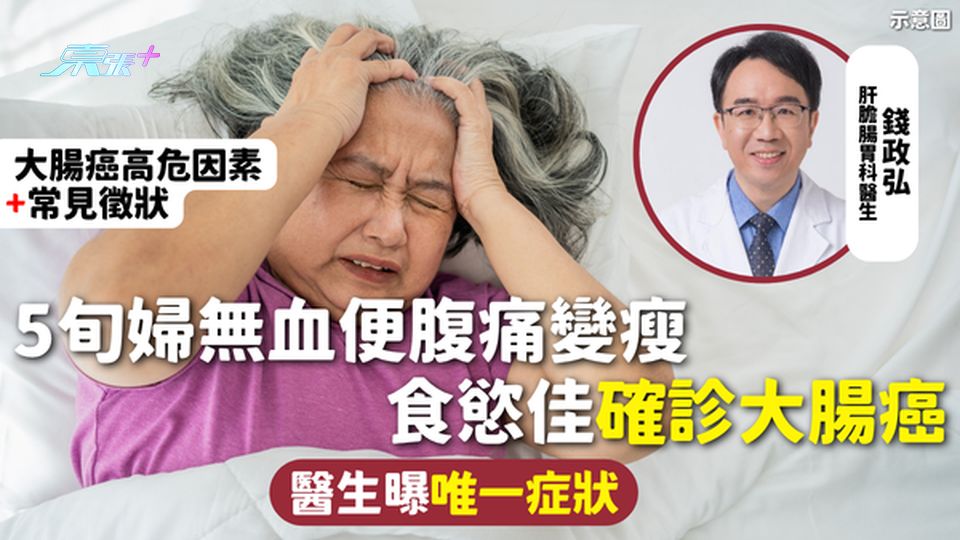 大腸癌 | 5旬婦無血便腹痛變瘦 食慾佳確診大腸癌 醫生曝唯一症狀 附大腸癌高危因素+常見徵狀