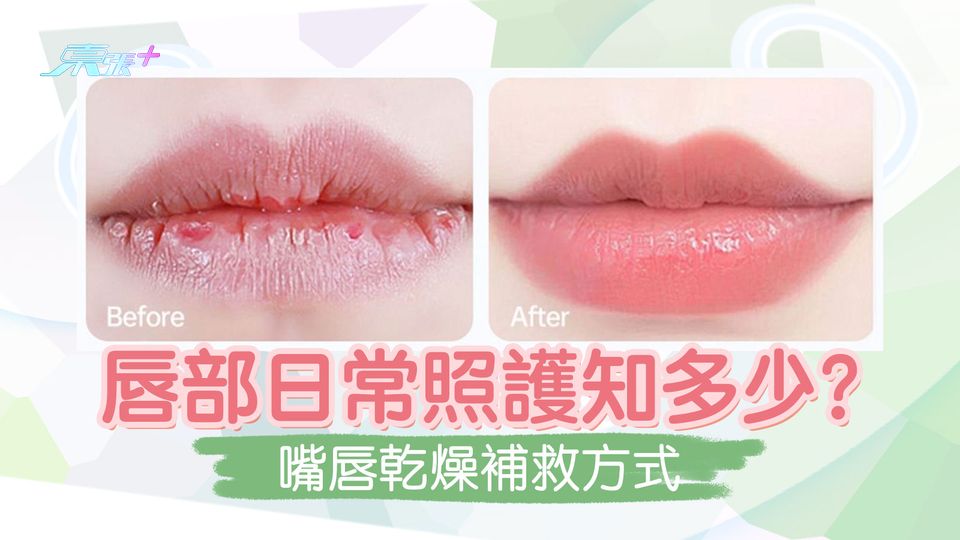 唇部日常照護知多少？嘴唇乾燥補救方式