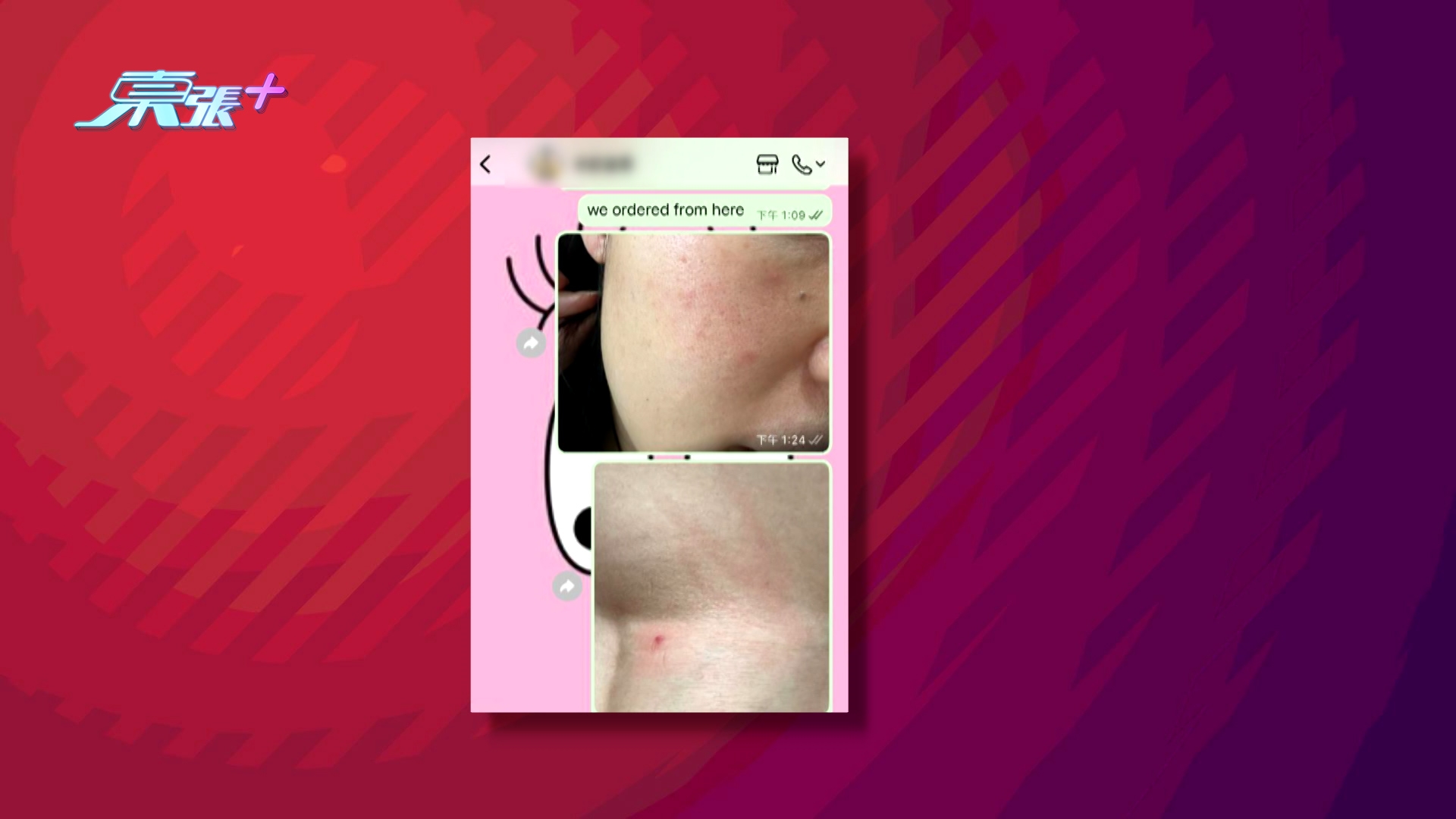 王女士及陳女士比較幸運，經多次投訴後終獲退款，但網上有不少苦主就沒有如此好運，更有人指吃完後皮膚敏感「起粒粒」，非常可憐！