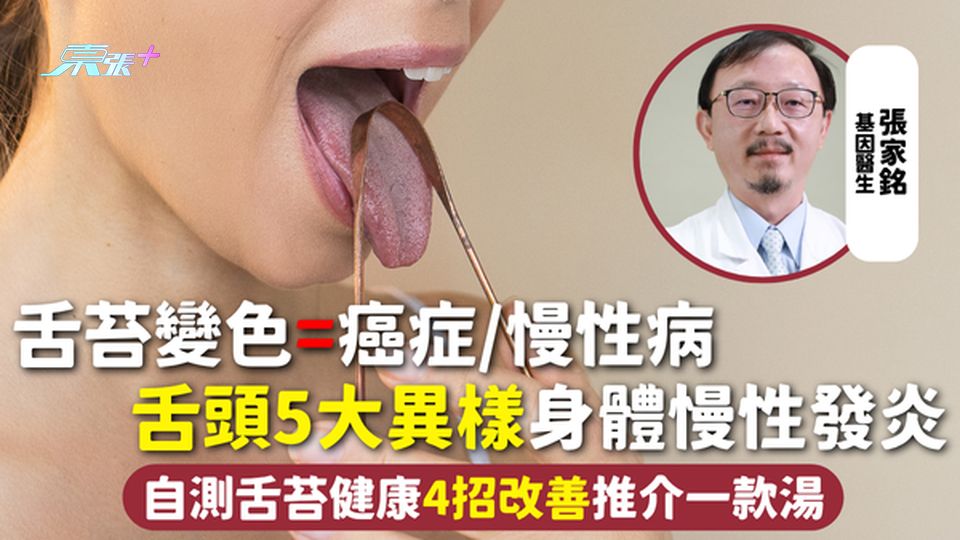 舌苔 | 舌苔變色=癌症/慢性病 舌頭5大異樣身體慢性發炎 自測舌苔健康4招改善推介一款湯
