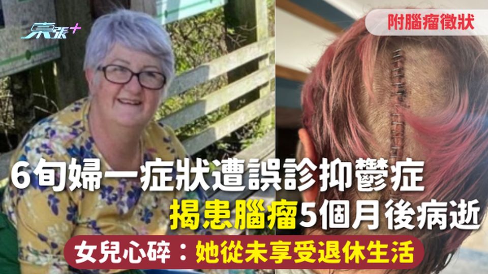 腦瘤 | 6旬婦一症狀遭誤診抑鬱症 揭患腦瘤5個月後病逝 女兒心碎：她從未享受退休生活 附腦瘤徵狀