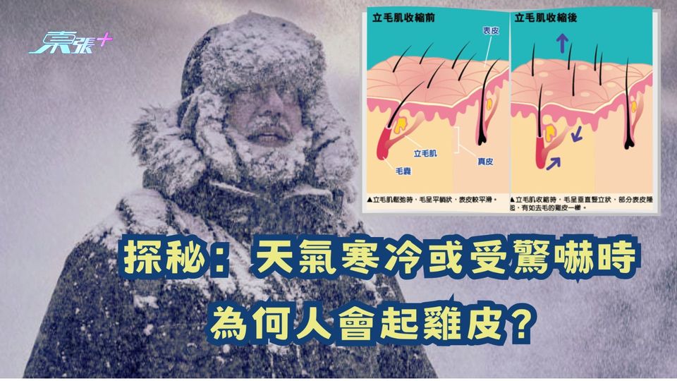 探秘：天氣寒冷或受到驚嚇時 為何人會起雞皮？