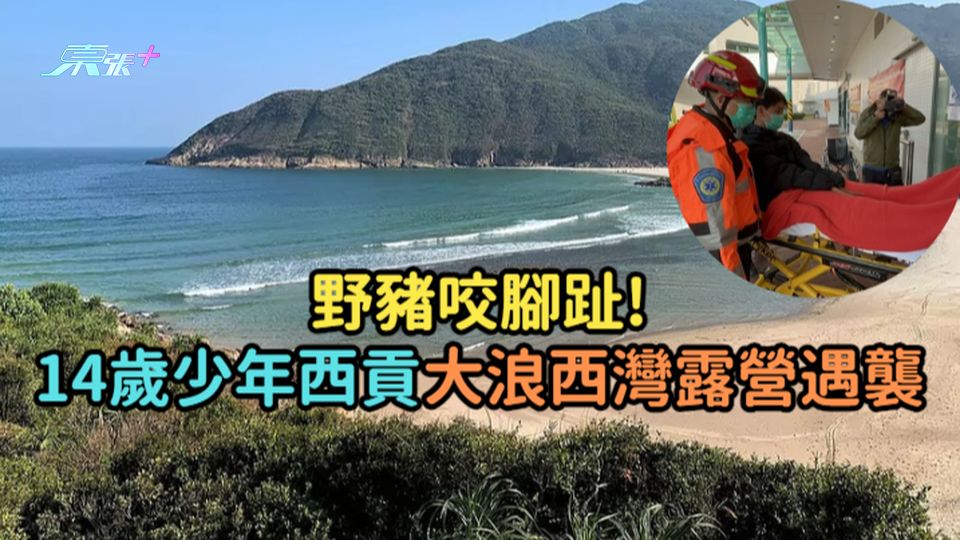 野豬咬腳趾!  14歲少年西貢大浪西灣露營遇襲送院治理