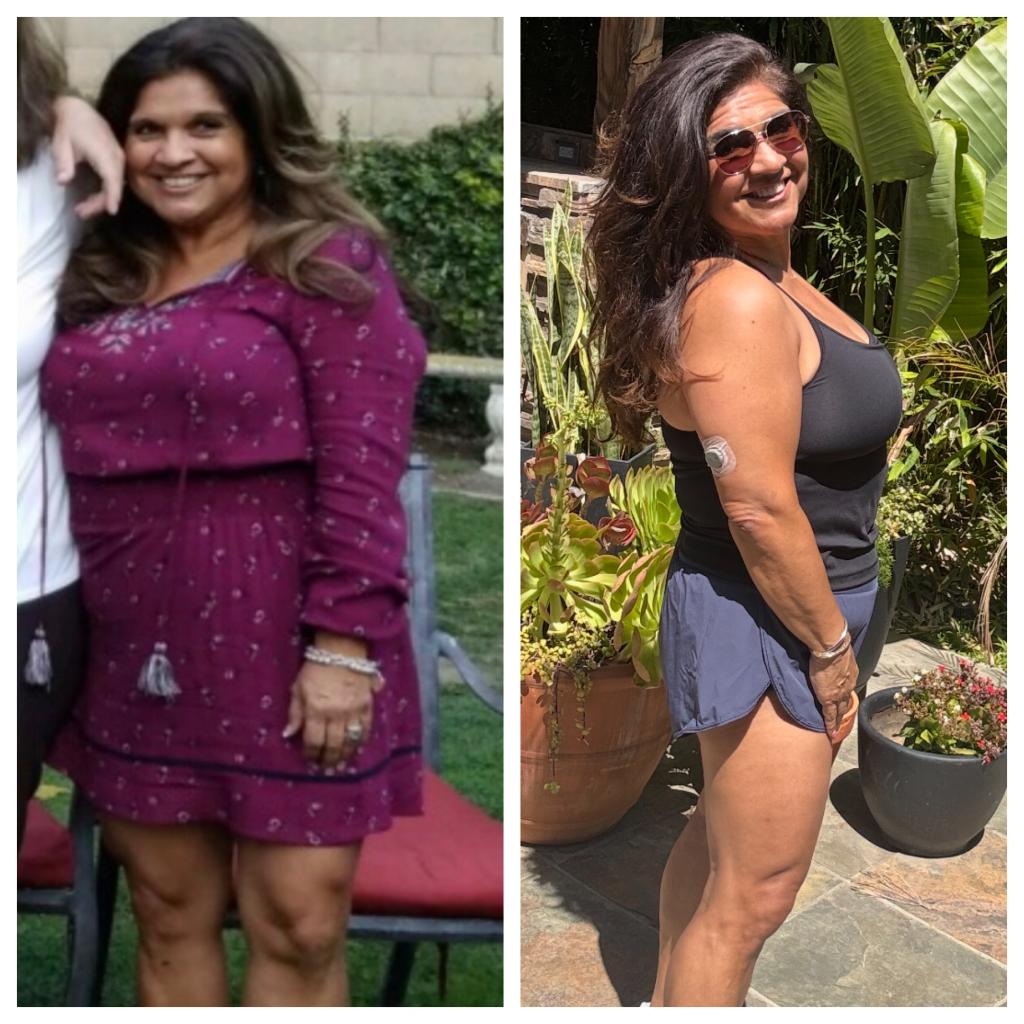 諾瑪·萊昂斯 (Norma Lyons) 的康復前後對比