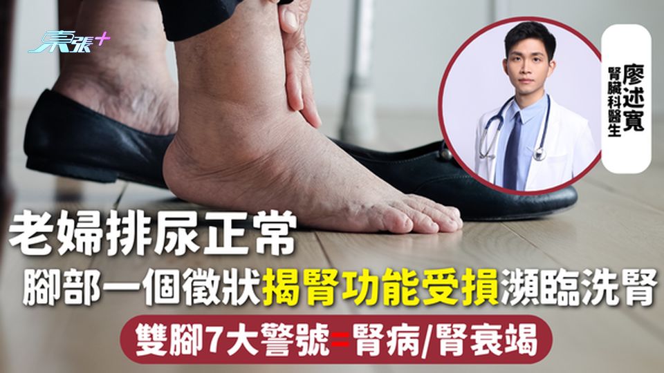 腎臟健康 | 老婦排尿正常 腳部一個徵狀揭腎功能受損瀕臨洗腎 雙腳7大警號=腎病/腎衰竭
