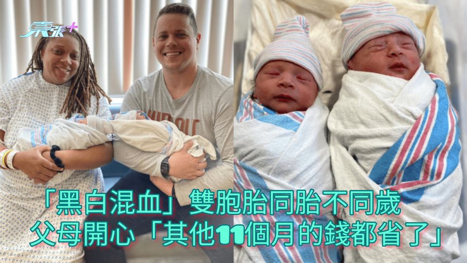 「黑白混血」雙胞胎同胎不同歲 父母開心「其他11個月的錢都省了」