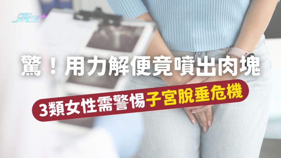 【驚!用力解便竟噴出肉塊】3類女性需警惕子宮脫垂危機 #至識健康