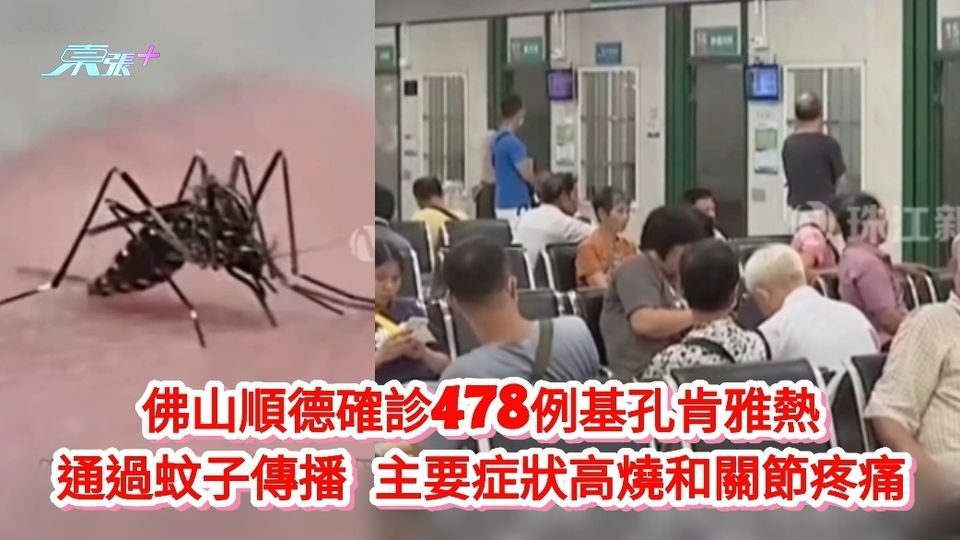 佛山順德確診478例基孔肯雅熱 通過蚊子傳播 主要症狀高燒和關節疼痛