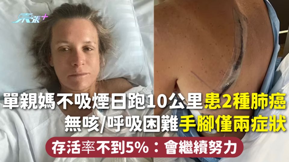 肺癌 | 單親媽不吸煙日跑10公里患2種肺癌 無咳/呼吸困難手腳僅兩症狀 存活率不到5%：會繼續努力