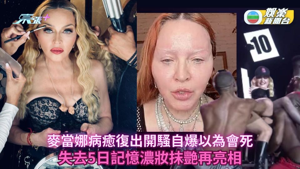 麥當娜病癒復出開騷自爆以為會死 失去5日記憶疑似素顏照流出？