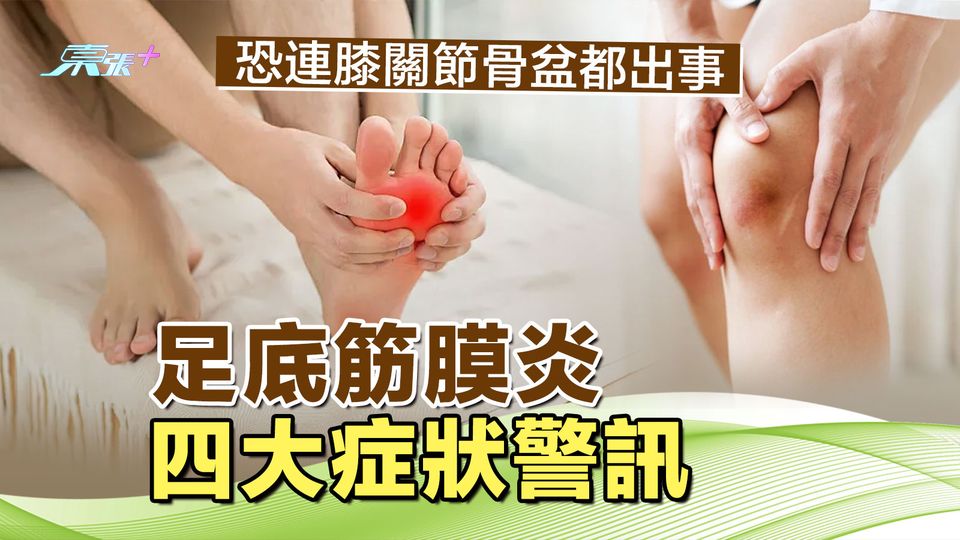 足底筋膜炎四大症狀警訊 恐連膝關節骨盆都出事