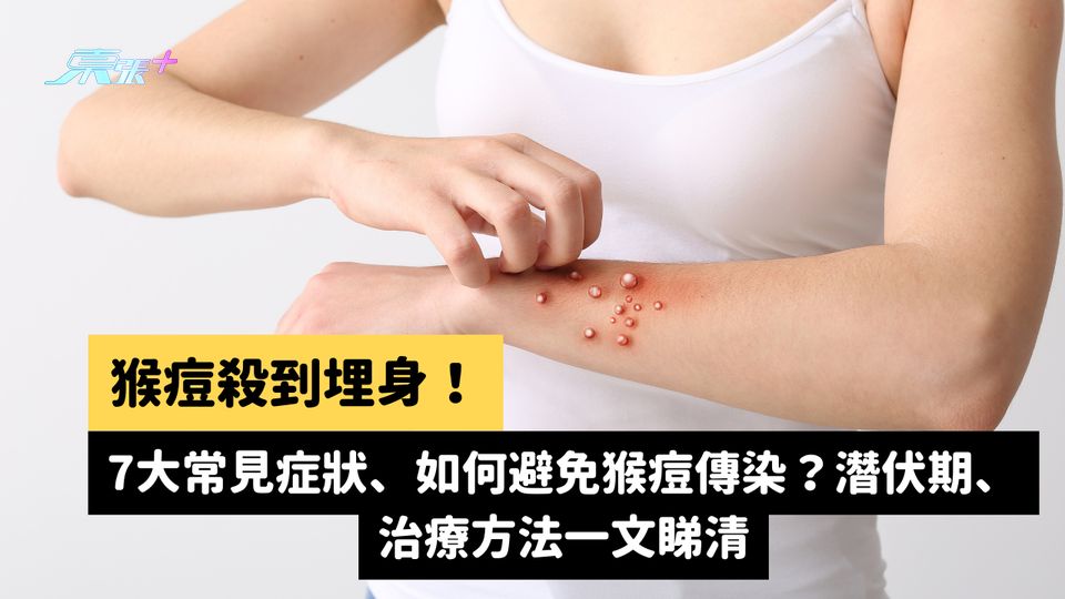 猴痘殺到埋身！7大常見症狀、如何避免猴痘傳染？潛伏期、治療方法一文睇清 #至識健康
