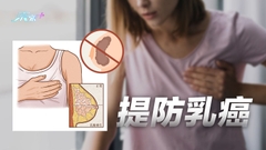 專科醫生教你提防乳癌