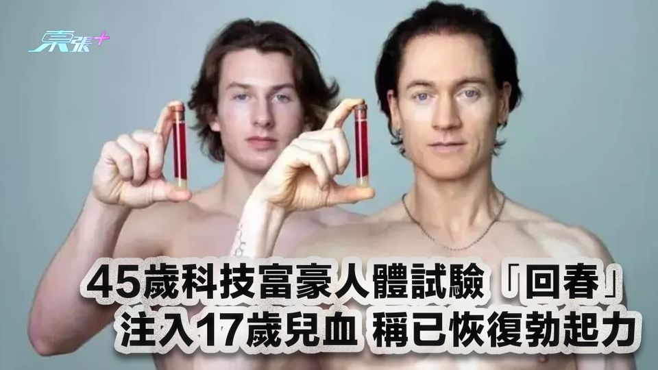 45歲科技富豪人體試驗「回春」 注入17歲兒血 稱已恢復勃起力
