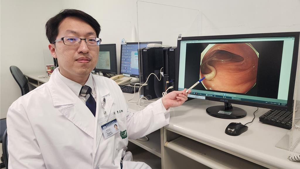 大林慈濟肝膽腸胃內科醫師曾勗桓表示，經由大腸鏡檢查，赫然在患者乙狀結腸發現兩條白色蠕蟲。（大林慈濟醫院提供／呂妍庭嘉義傳真）