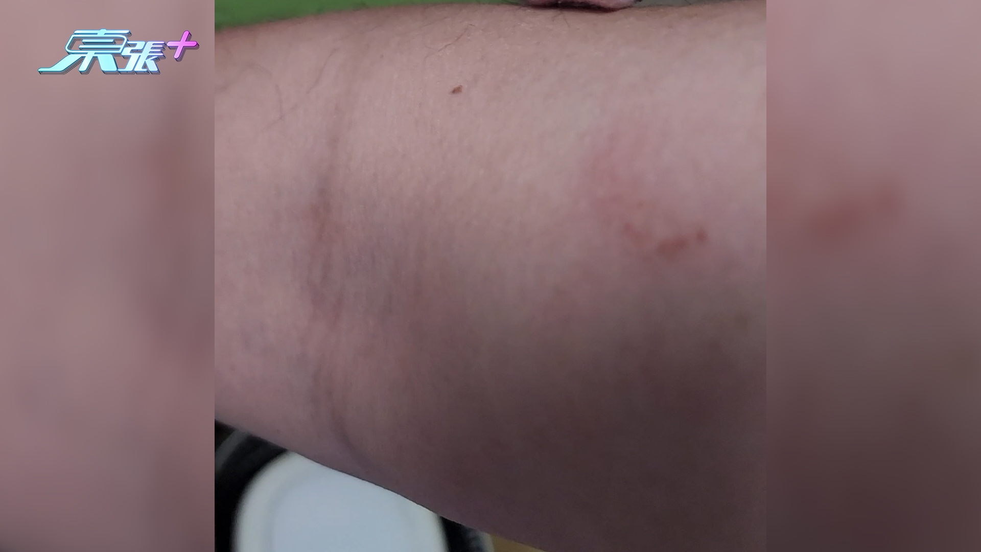 東張西望報料｜荃灣店舖維修「突釘整親人」　報料者：整爛衫仲整損手臂 (觀眾沈先生提供)