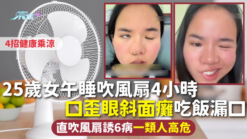 風扇危機 | 25歲女午睡吹風扇4小時 口歪眼斜面癱吃飯漏口 直吹風扇誘6病一類人高危 4招健康乘涼