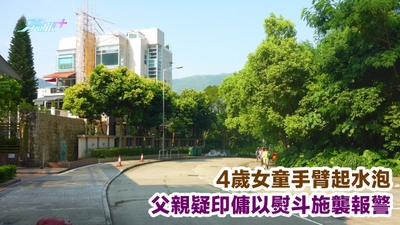 4歲女童手臂起水泡 父親疑印傭以熨斗施襲報警
