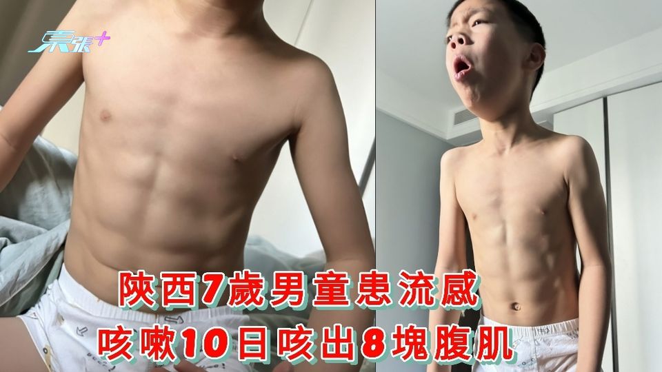 有片 | 陝西7歲男童患流感 咳嗽10日咳出8塊腹肌
