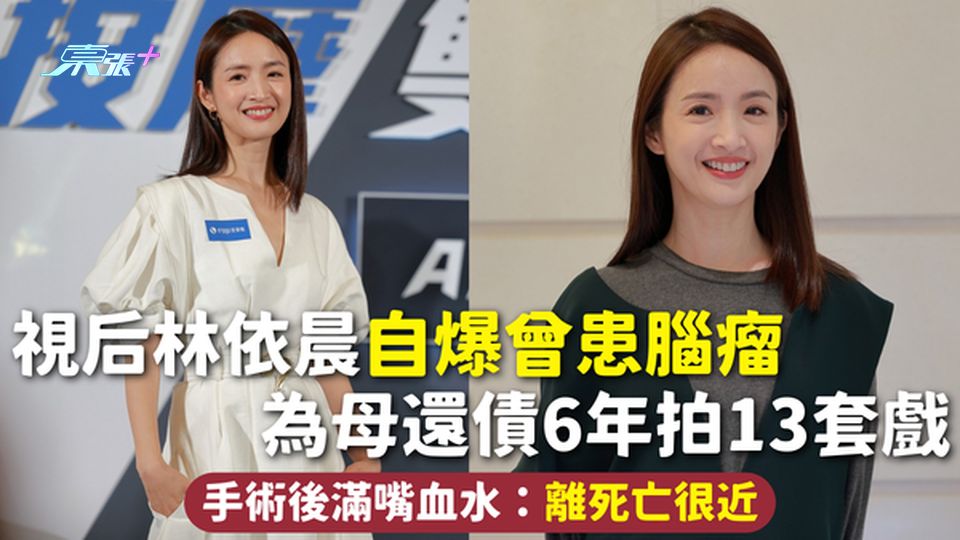 腦瘤 | 視后林依晨自爆曾患腦瘤 為母還債6年拍13套戲 手術後滿嘴血水：離死亡很近