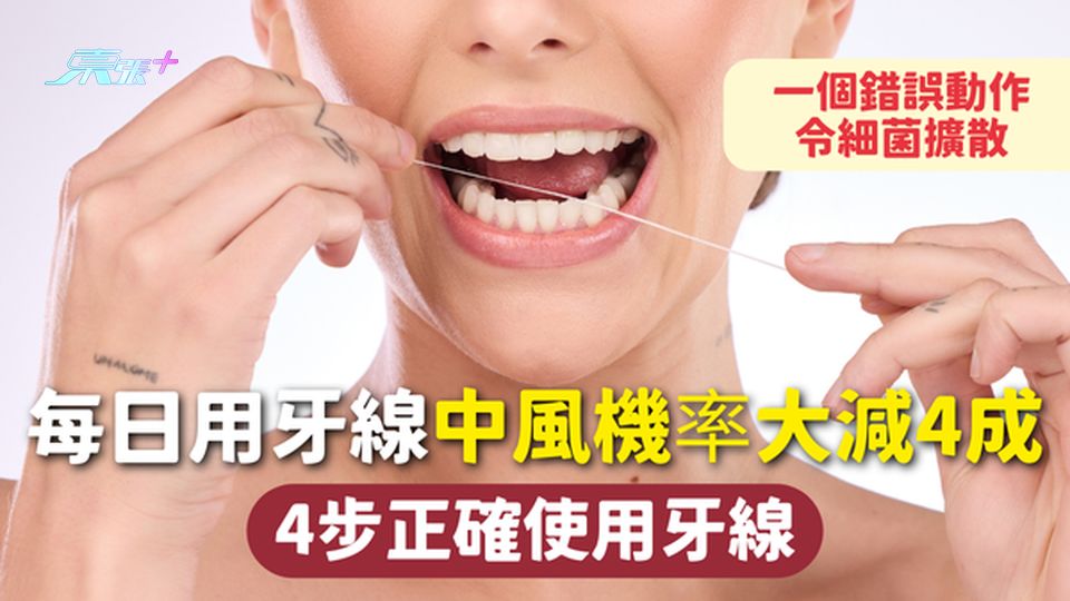 中風 | 每日用牙線中風機率大減4成 4步正確使用牙線 一個錯誤動作令細菌擴散
