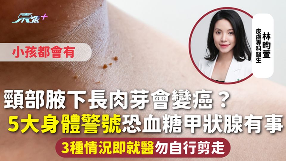 肉芽｜頸部腋下長肉芽會變癌？5大身體警號恐血糖甲狀腺有事 小孩都會有 3種情況即就醫勿自行剪走