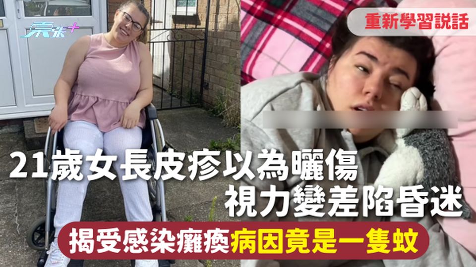 蚊蟲感染 | 21歲女長皮疹以為曬傷 視力變差陷昏迷 揭受感染癱瘓重學說話 病因竟是一隻蚊