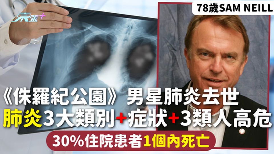 肺炎｜78歲《侏羅紀公園》男星肺炎去世 肺炎3大類別+症狀+3類人高危 30%住院患者1個內死亡