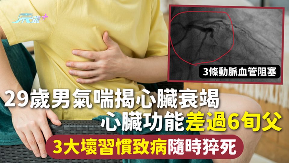 心臟衰竭 | 29歲男氣喘揭心臟衰竭 心臟功能差過6旬父 3大壞習慣致病隨時猝死