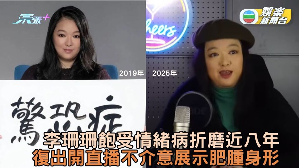 李珊珊飽受情緒病折磨近8年 復出開直播不介意展示肥腫身形