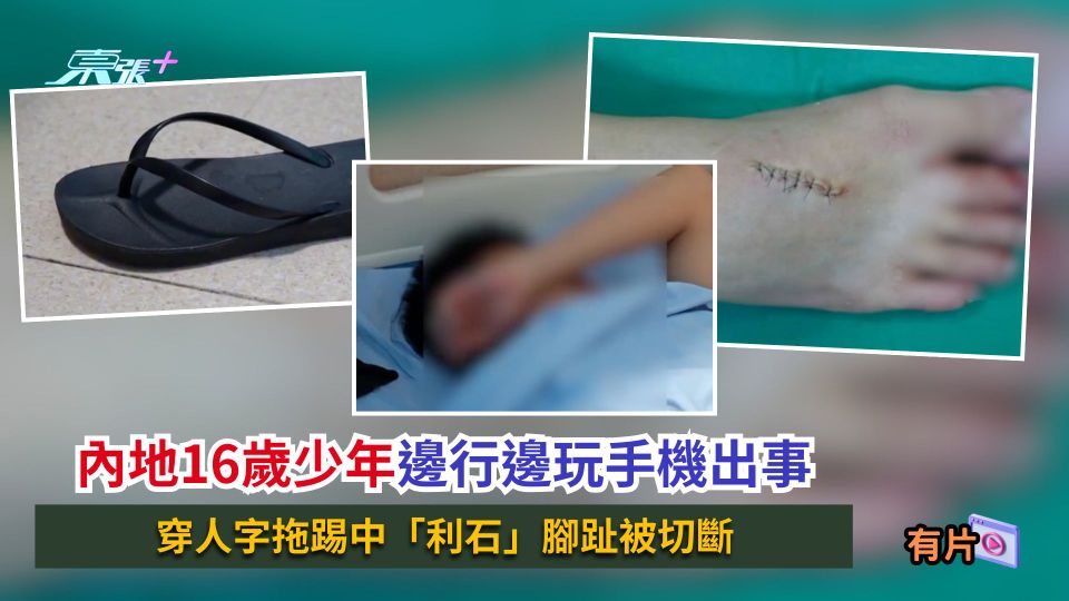 內地16歲少年邊行邊玩手機出事　穿人字拖踢中「利石」腳趾被切斷