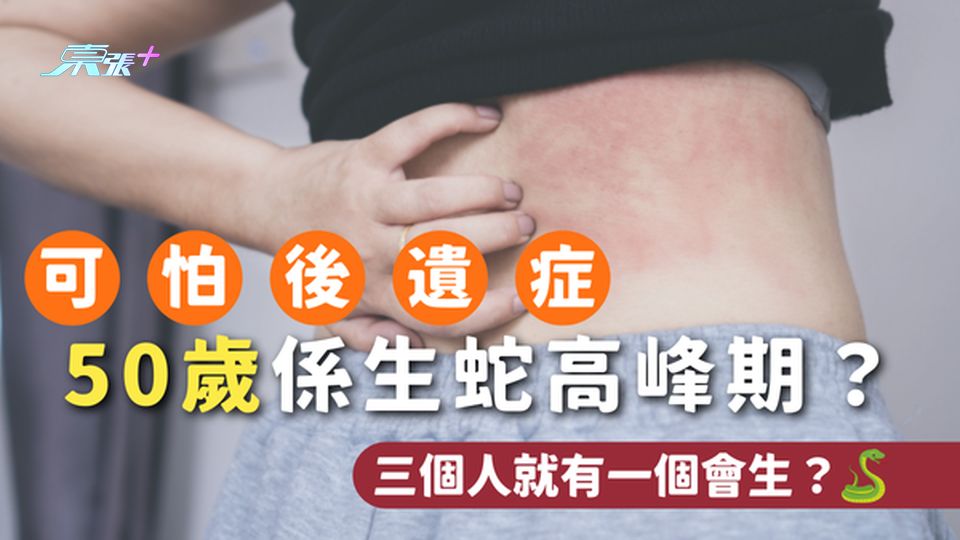 三個人就有一個會生蛇？ 🐍  50 歲係生蛇高峰期 🥲｜生蛇後遺症好可怕！