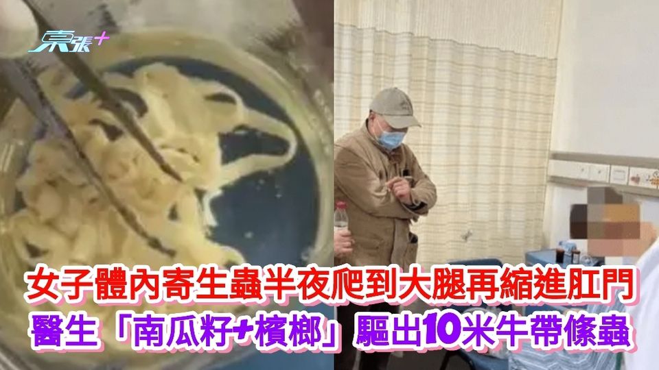 有片｜女子感染寄生蟲半夜爬到大腿再縮進肛門 醫生古法驅出10米牛帶絛蟲
