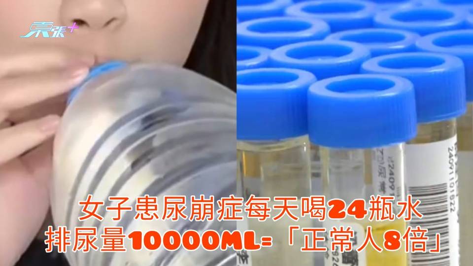有片 | 女子患尿崩症每天喝24瓶水 排尿量10000ML=「正常人8倍」