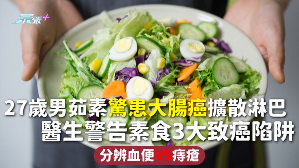 大腸癌 | 27歲男茹素驚患大腸癌擴散淋巴 醫生警告素食3大致癌陷阱 分辨血便VS痔瘡