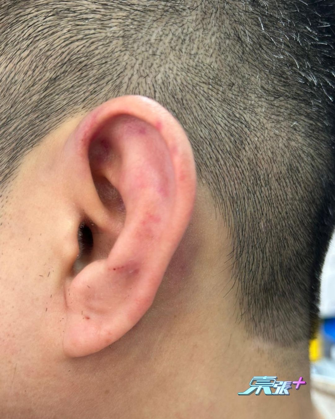 筲箕灣MMA｜員工慘被狂毆　今回應「東張+」已報警　事主：今日又嘔又暈