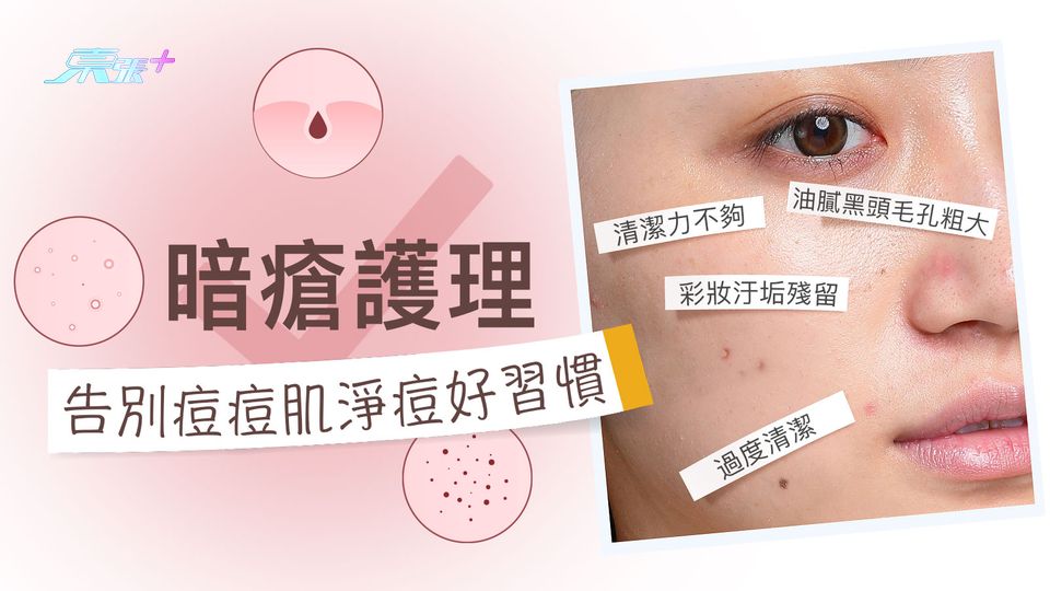暗瘡護理 告別痘痘肌養生好習慣