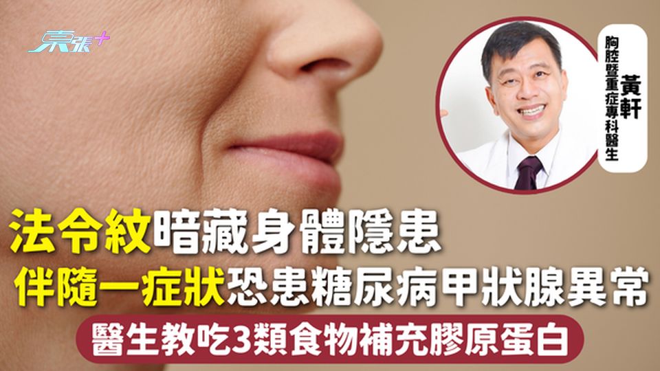 法令紋 | 暗藏身體隱患 伴隨一症狀恐患糖尿病甲狀腺異常 醫生教吃3類食物補充膠原蛋白