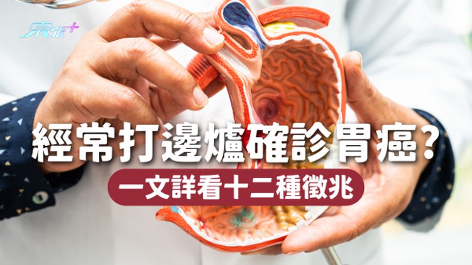 經常打邊爐 2年後確診胃癌😷第6大致命癌症 出現12種徵兆要留意！
