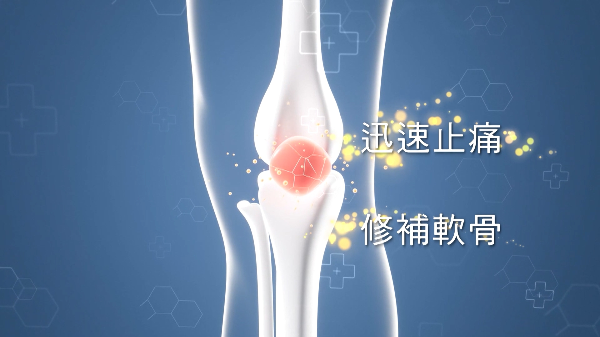 藥劑師建議，服用補充品時，可以留意入面有沒有針對修補關節的成分，有些醫學級別的關節筋肌配方，例如含有葡萄糖胺以及雙核心膠原蛋白這些成分，因為臨床證實，可以有效迅速止痛和修補軟骨，能全方位修補關節，改善筋骨勞損，令人體更靈活。