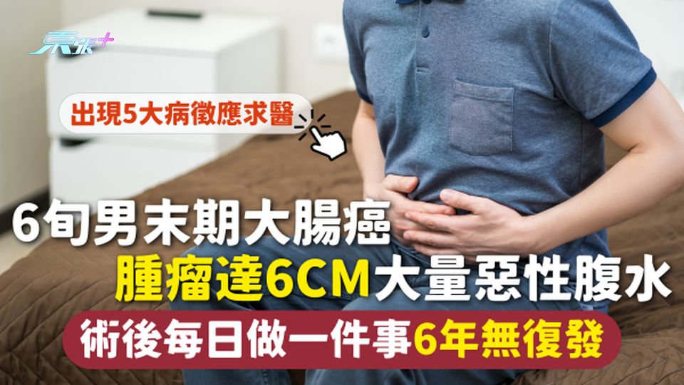大腸癌 | 6旬男末期大腸癌 腫瘤達6cm大量惡性腹水 術後每日做一件事6年無復發