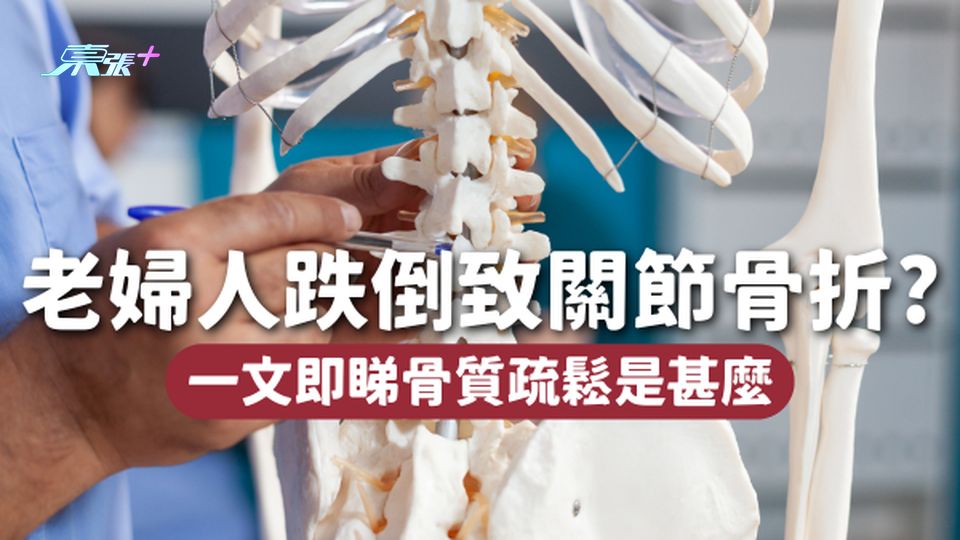 雨傘當手杖🌂75歲婦人跌倒引致髖關節骨折 原來患上骨質疏鬆！