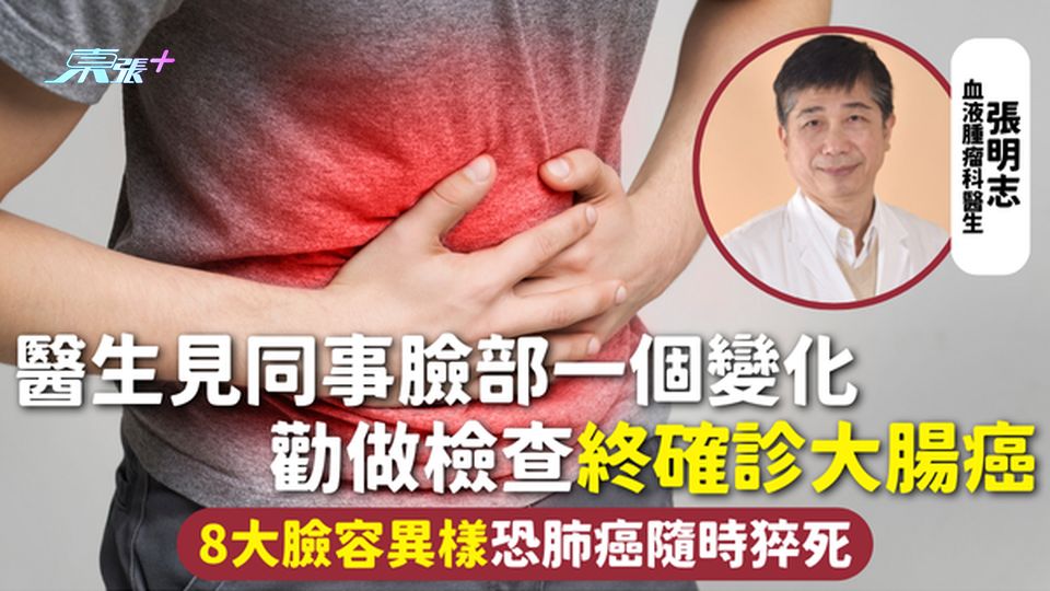 臉色健康 | 醫生見同事臉部一個變化 勸做檢查終確診大腸癌 8大臉容異樣恐肺癌隨時猝死