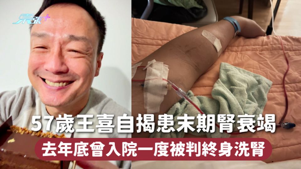 57歲王喜自揭患末期腎衰竭 去年底曾入院一度被判終身洗腎