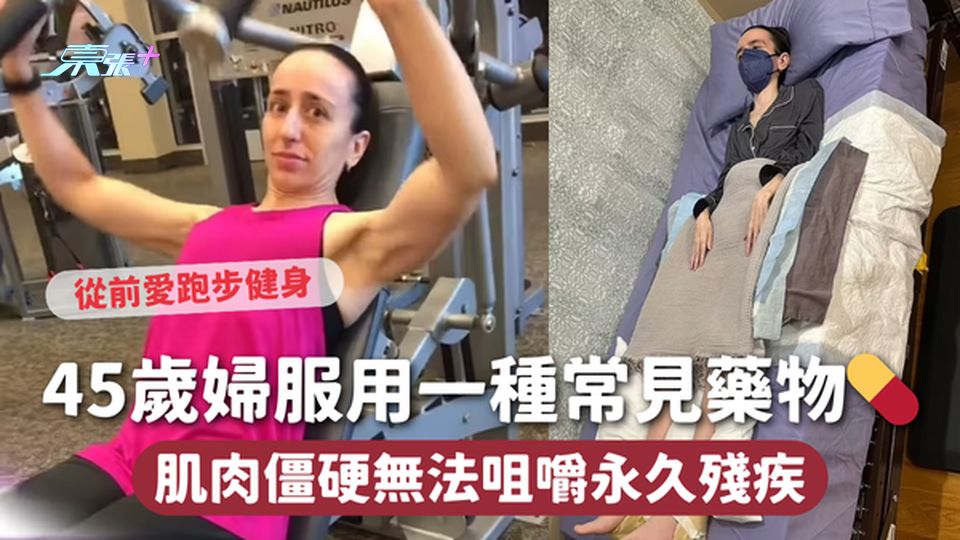 45歲婦服用一種常見藥物💊 肌肉僵硬無法咀嚼永久殘疾
